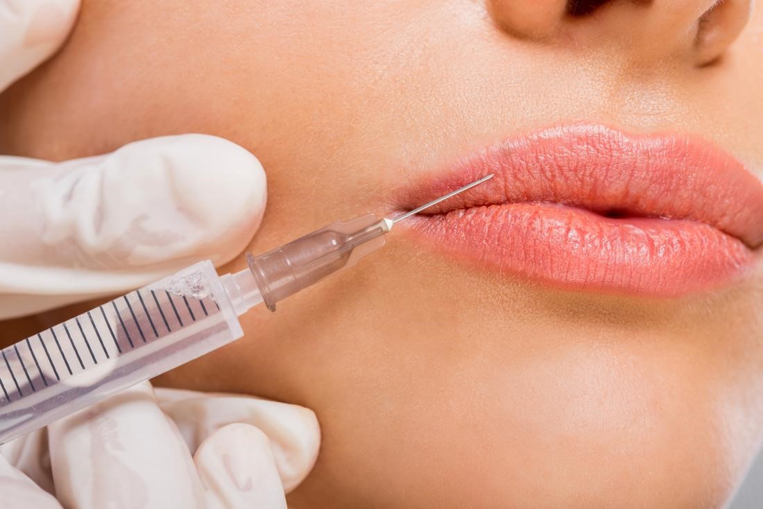 Injectable Treatments at SKiN